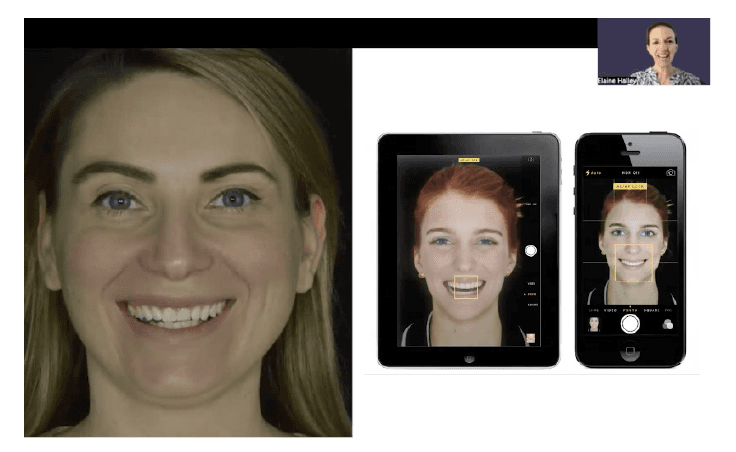 Facial and intraoral capture on tablet and phone, in the operatory